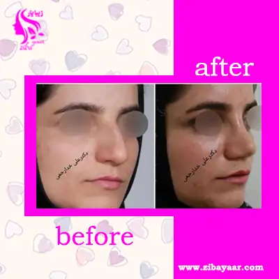نمونه عکس عمل دکتر علی خدارحمی
